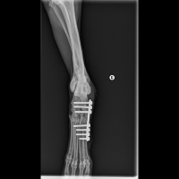 Radiographie post-opératoire après une chirurgie orthopédique